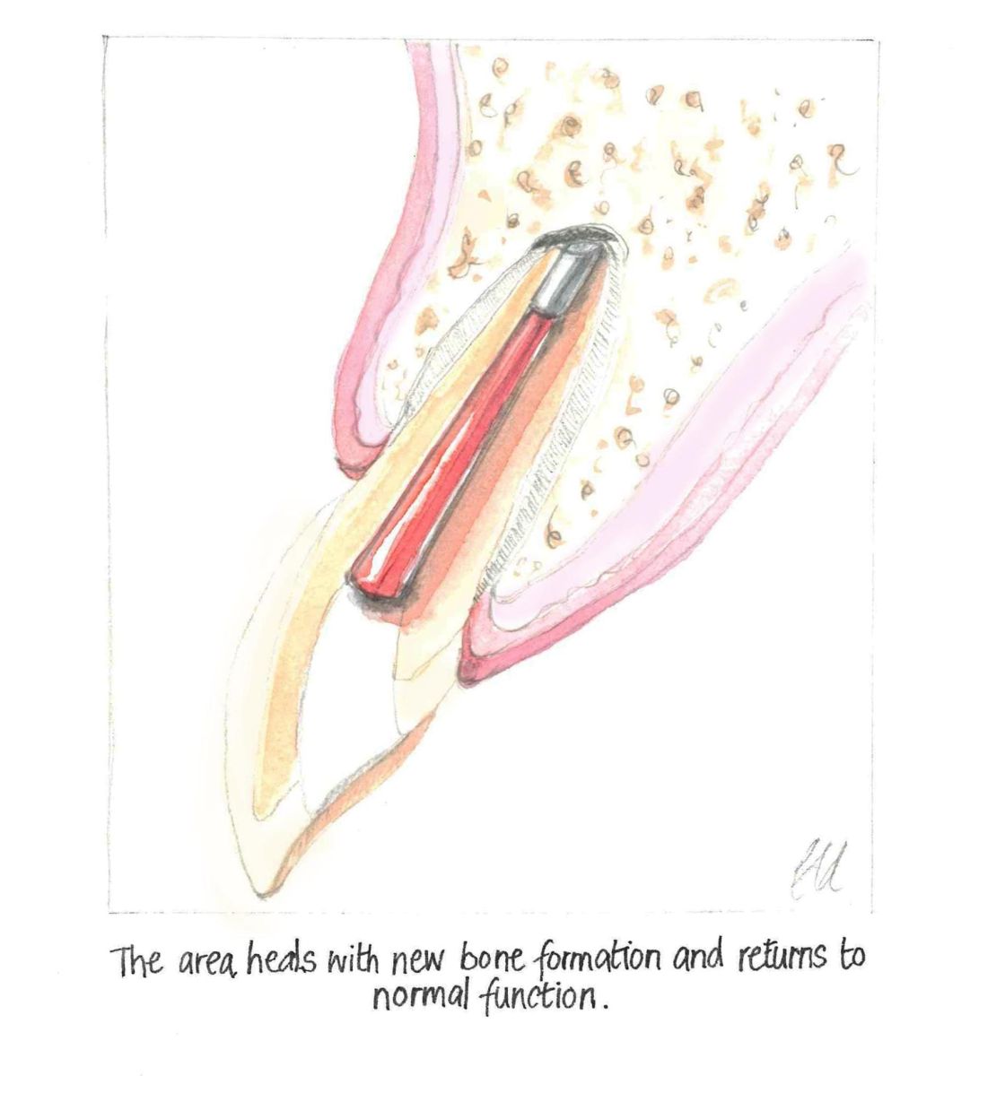 Dento-alveolar Surgery