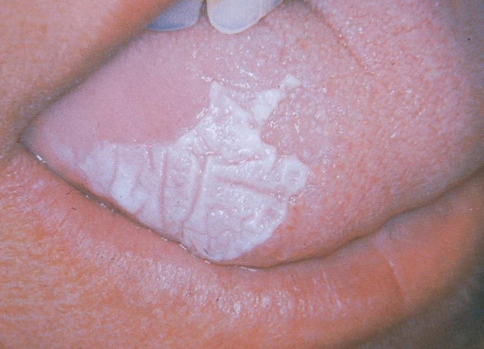 Oral Medicine