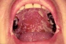 Oral Medicine