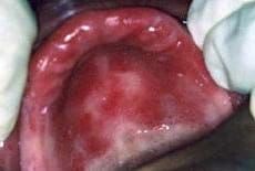 Oral Medicine