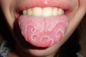 Oral Medicine