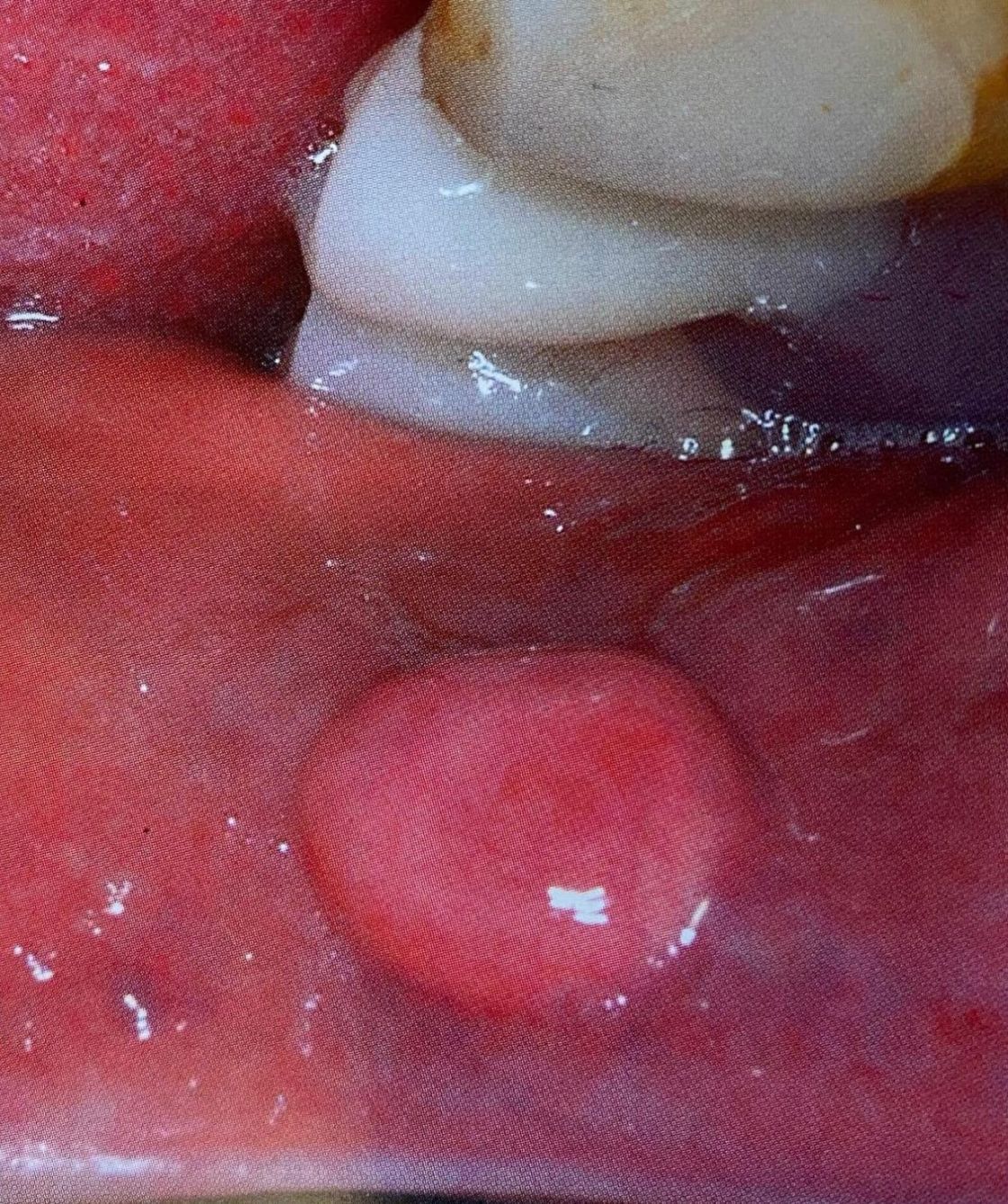 Oral Medicine