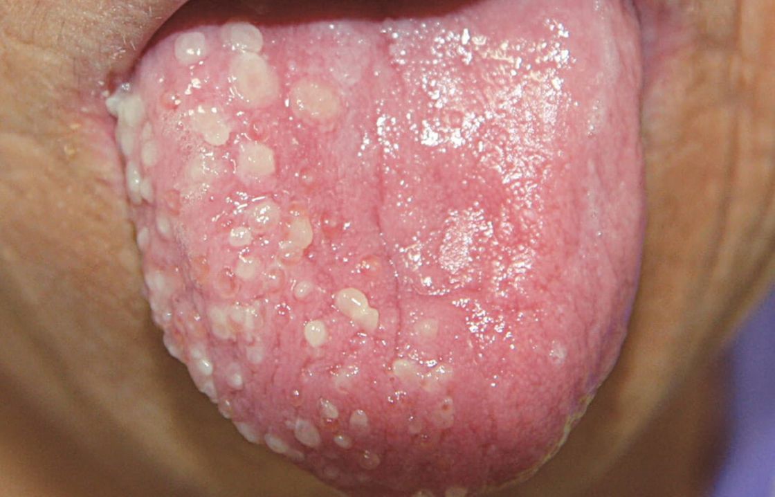 Oral Medicine